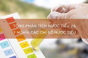 Ý nghĩa các chỉ số nước tiểu